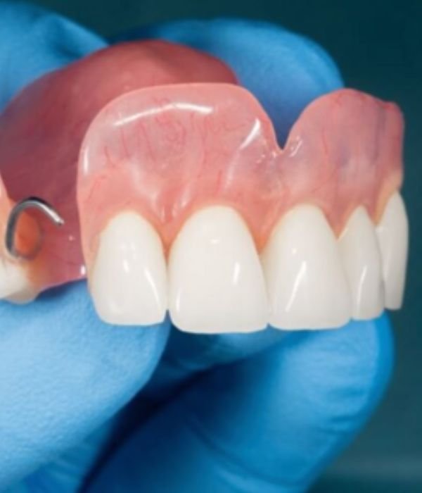 Immediate Dentures in Houston Tx