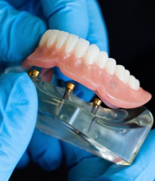 Snap-In Dentures  in Houston 